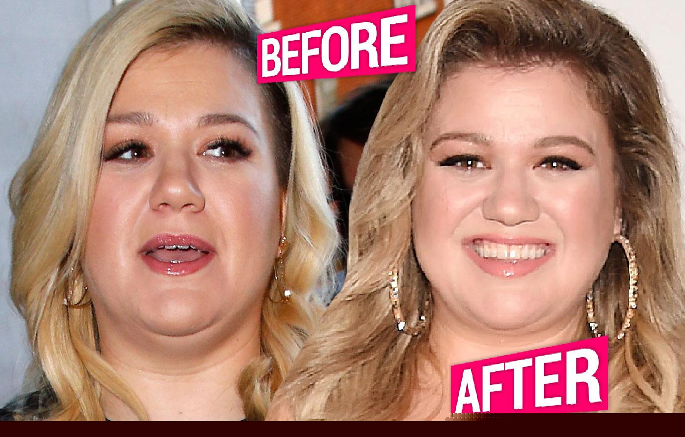 kelly clarkson diet gummies