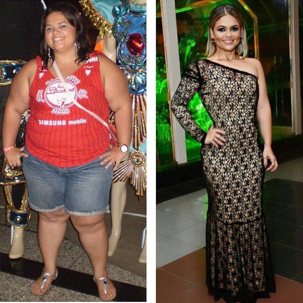 Before and After Weight Loss Photos