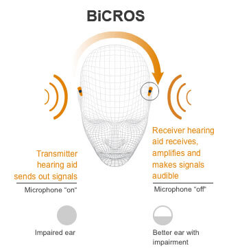 bicros hearing aid