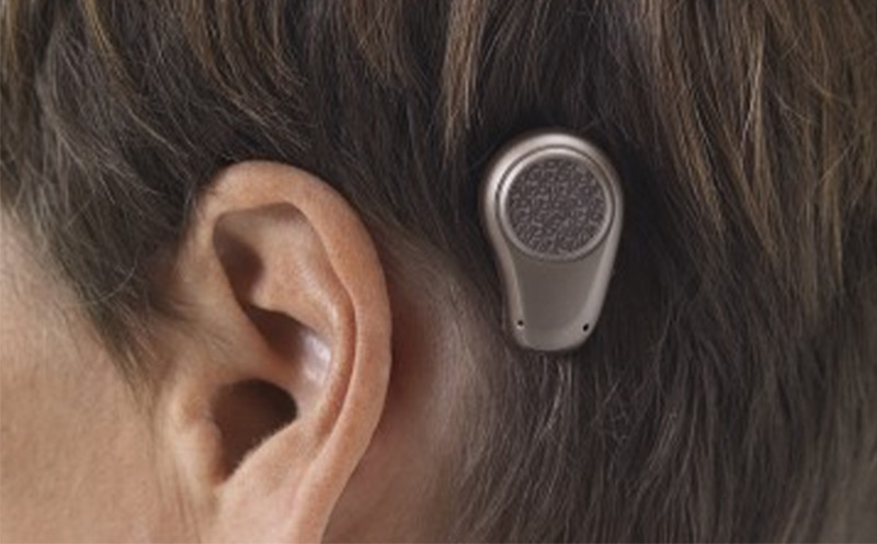 baha hearing aid