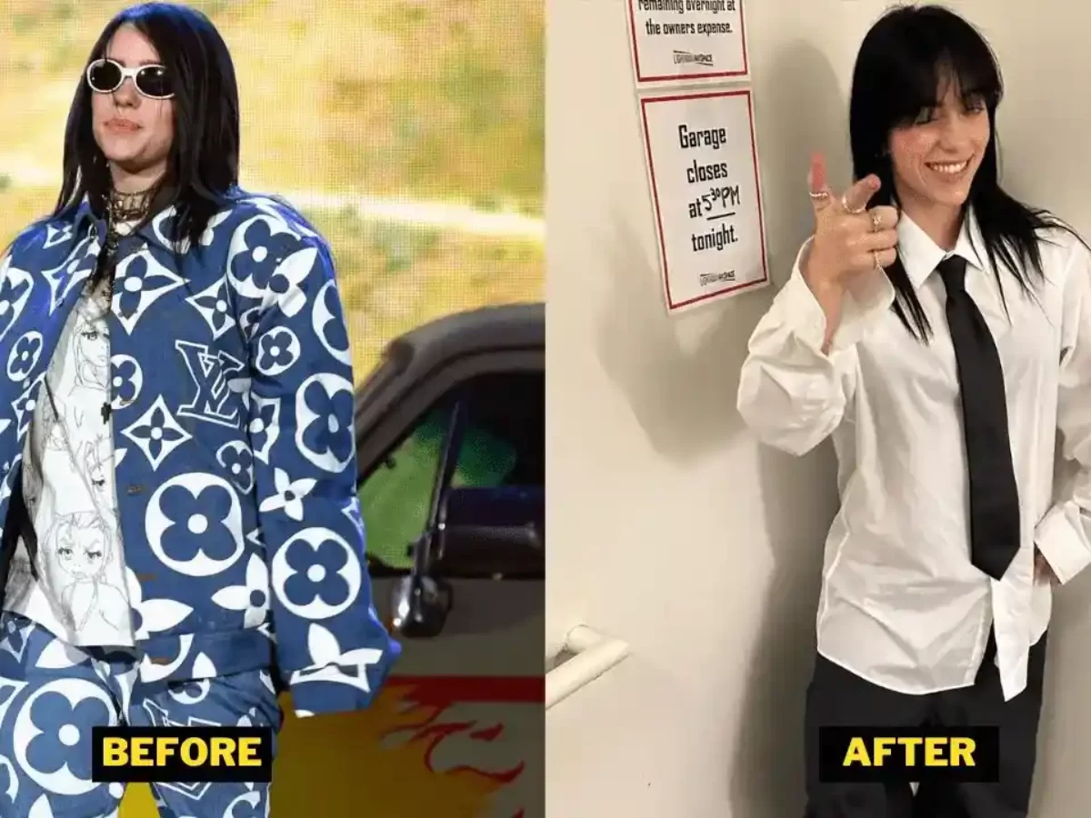 billie eilish weight loss