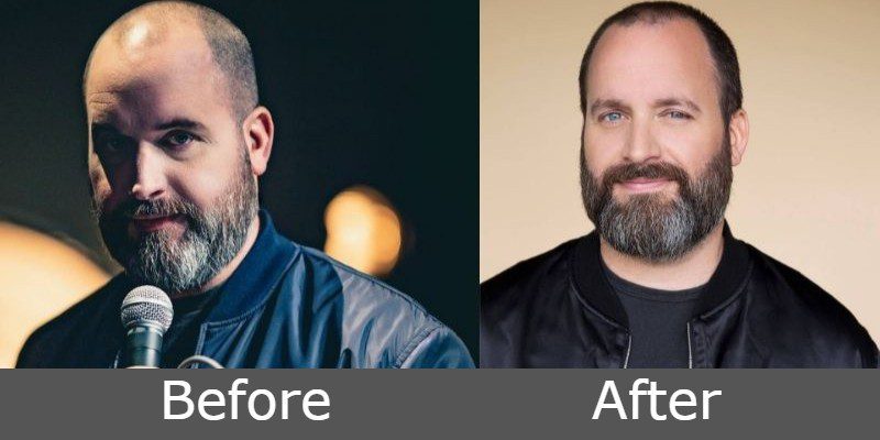 tom segura weight loss