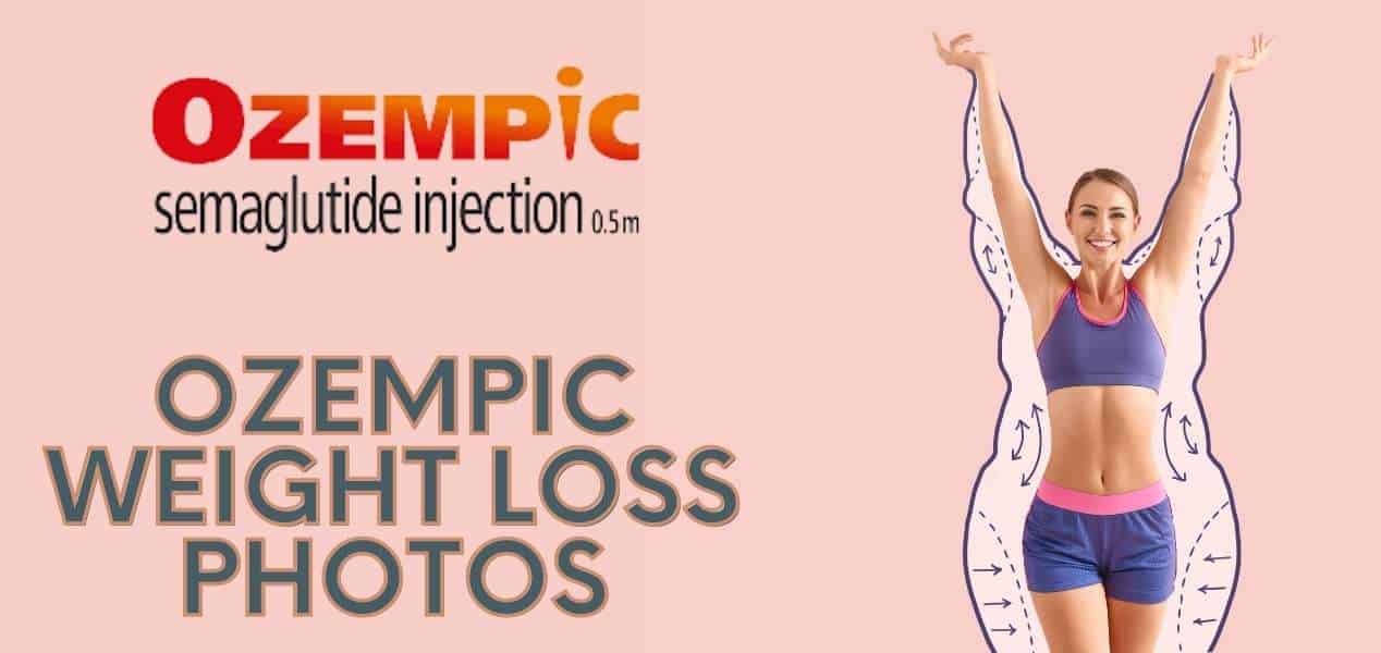 ozempic weight loss