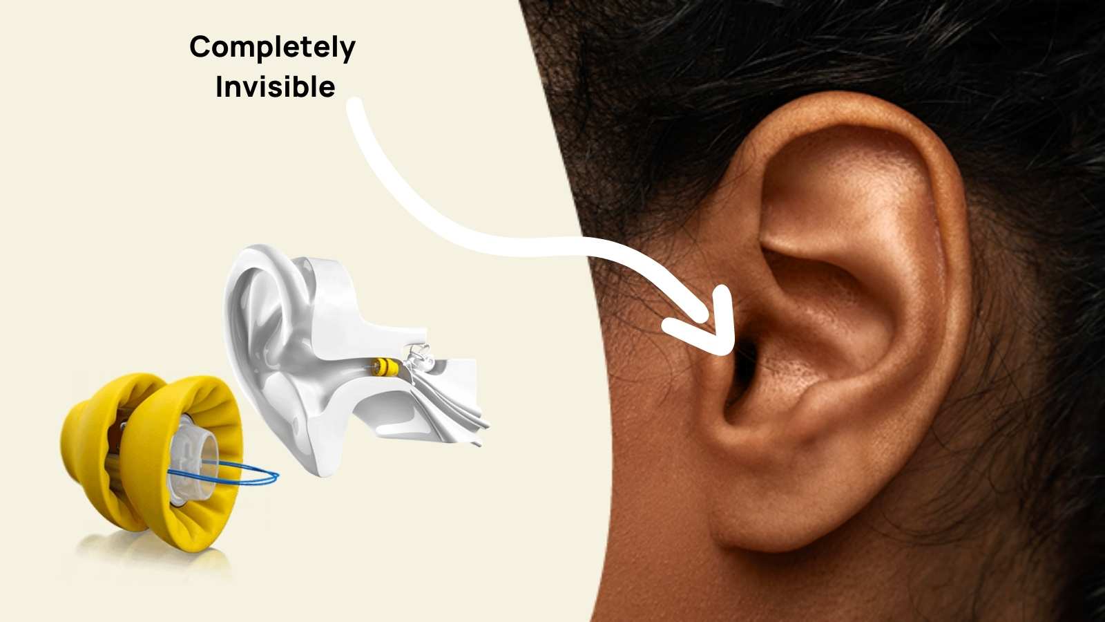 best tinnitus hearing aid