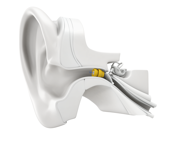 lyric hearing aid