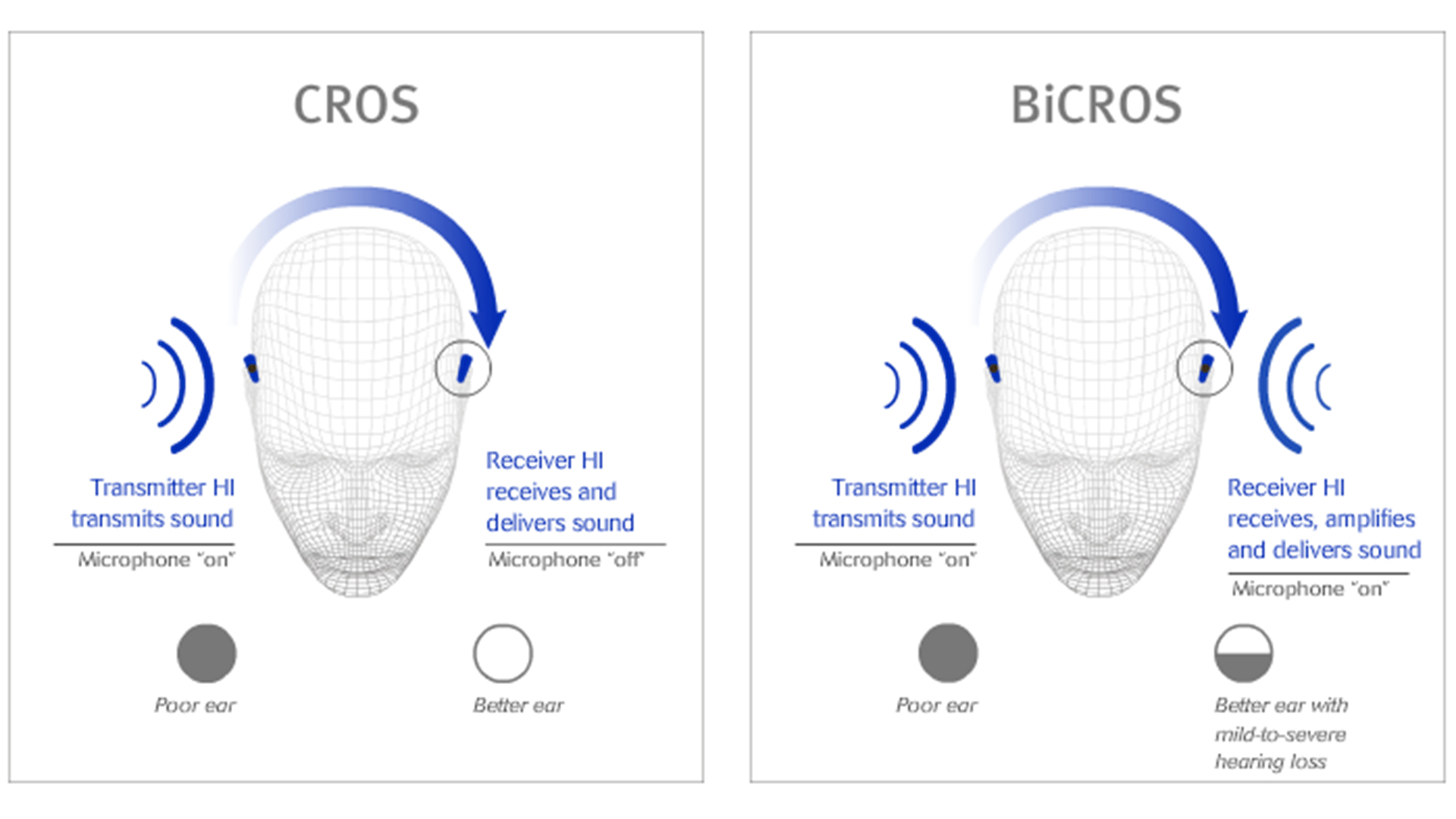 bicros hearing aid