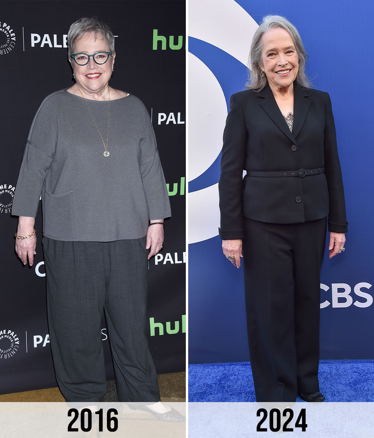 Kathy Bates Weight Loss: How She Lost 100 Pounds Naturally – Secrets