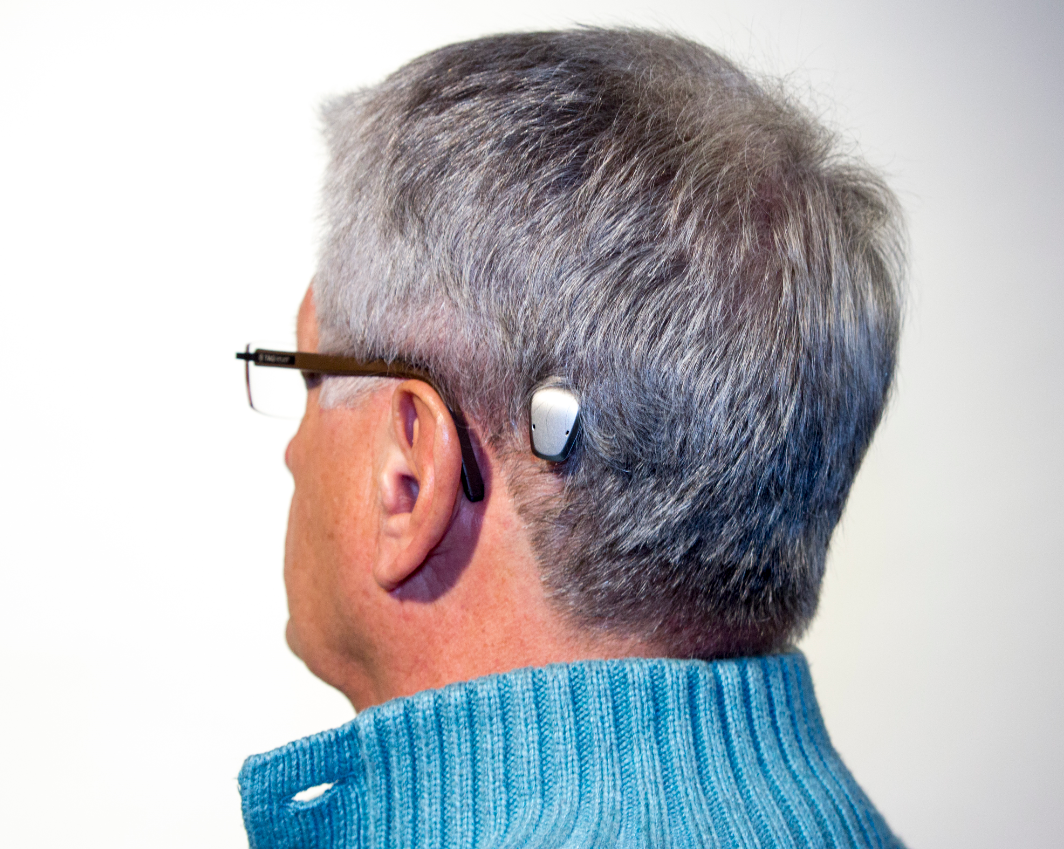 baha hearing aid