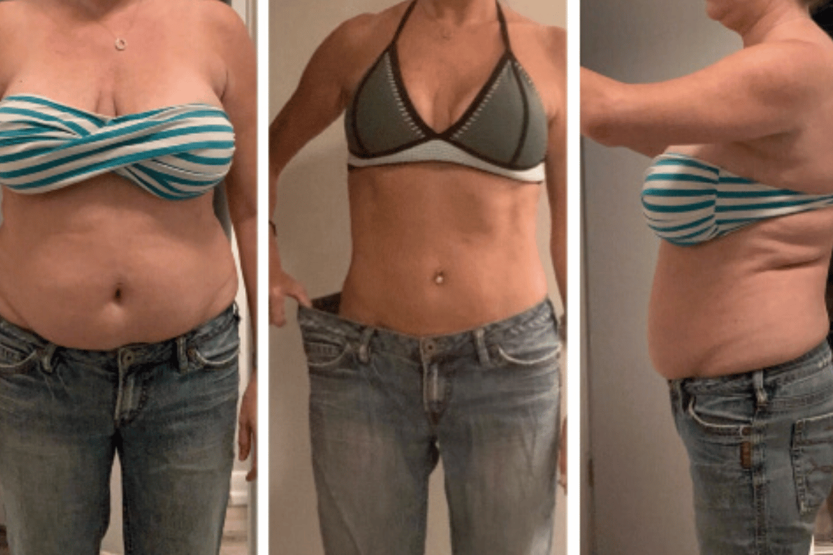 compounded tirzepatide weight loss results