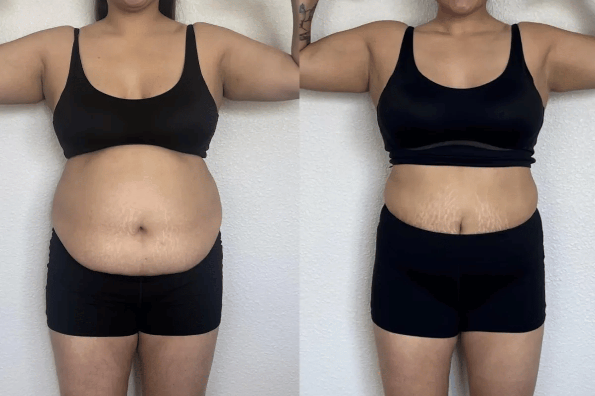 compounded tirzepatide weight loss graph by month
