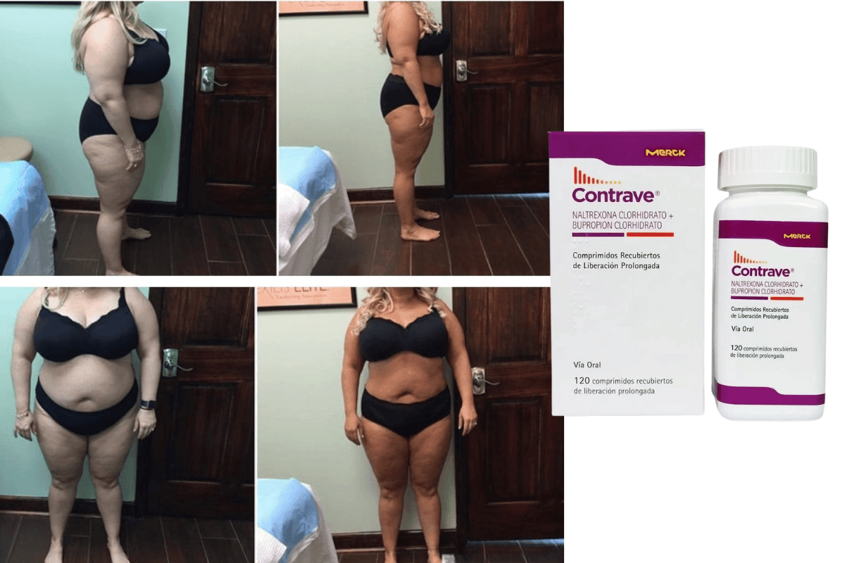 low dose naltrexone weight loss 