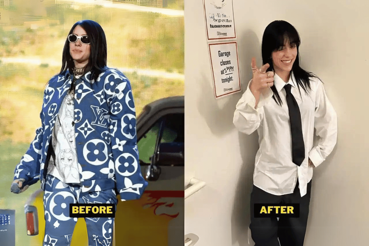 Billie Eilish weight loss