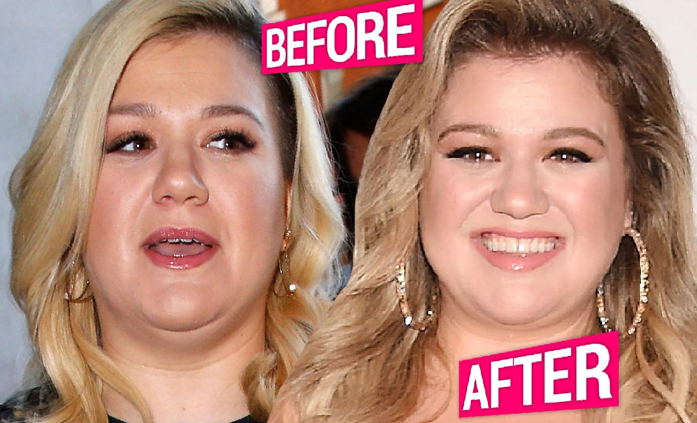 Did Kelly Clarkson Have Weight Loss Surgery