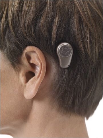 bone anchored hearing aid