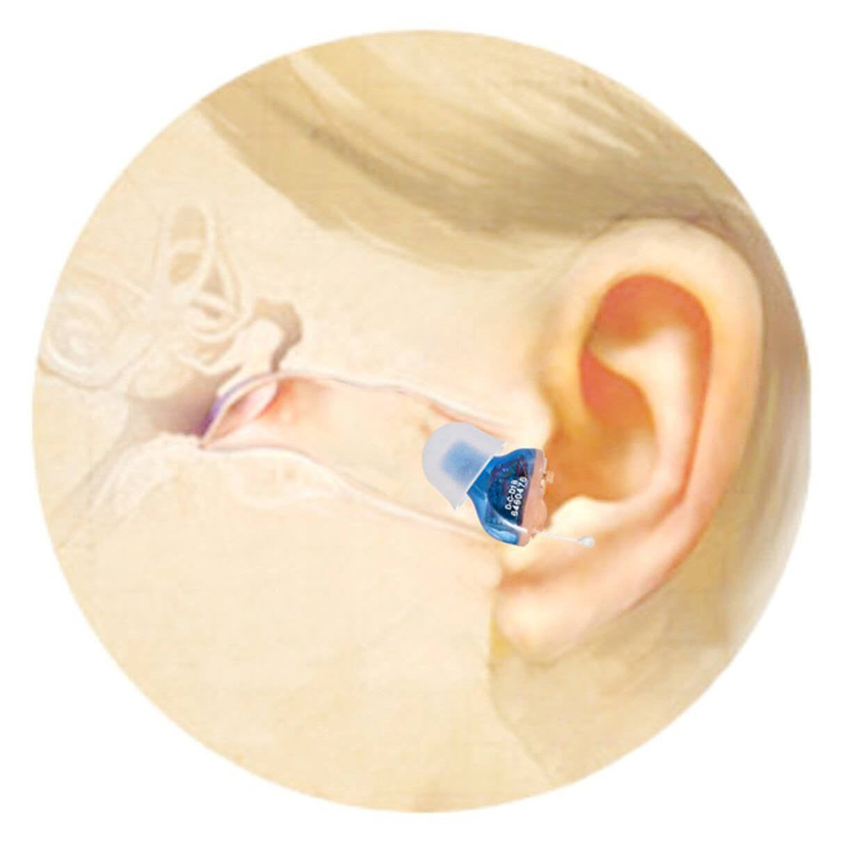 invisable hearing aids