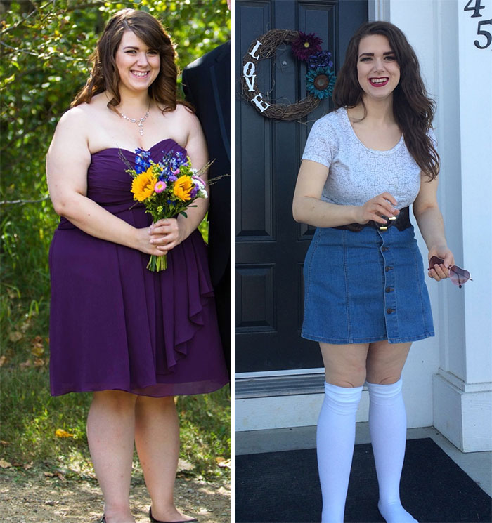 Before and After Weight Loss Photos