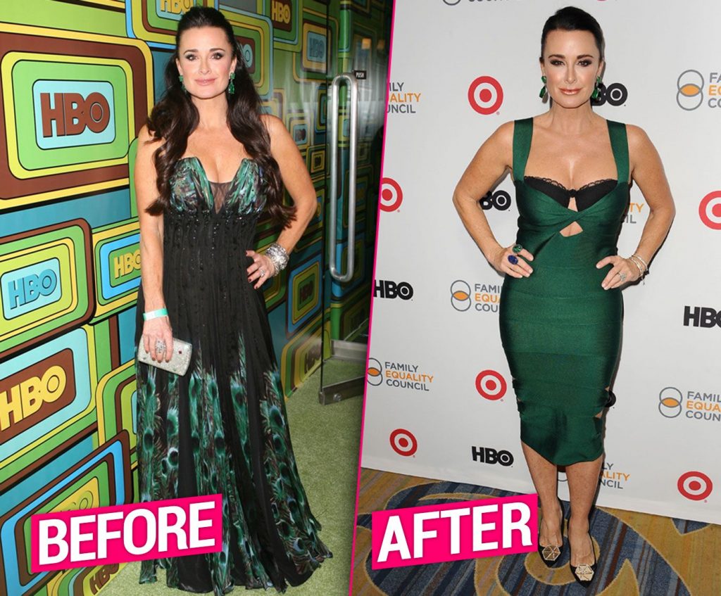 kyle richards weight loss