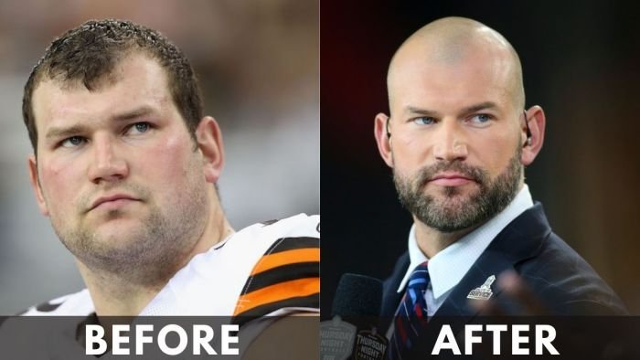 How Joe Thomas Achieved Weight Loss with Prohealth Keto ACV Gummies ...