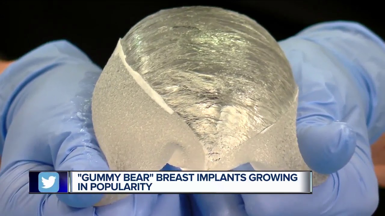 gummy bear implants before and after