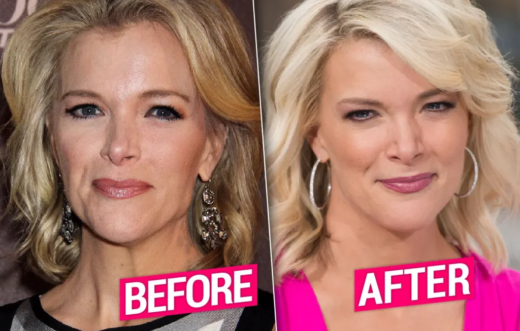 megyn kelly weight loss