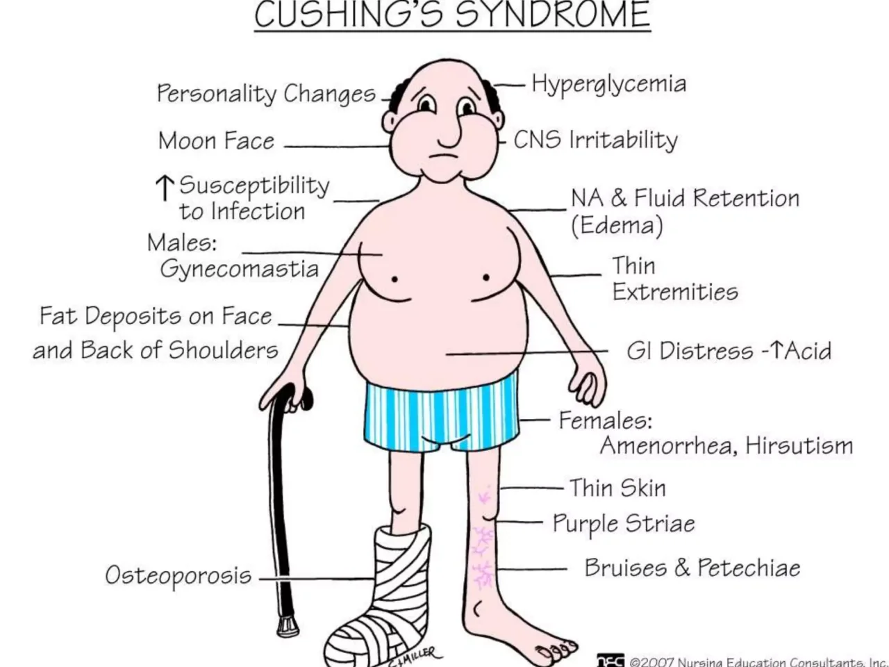 semaglutide and cushing's TrimRX | Cushings Can GLP-1 Medications Help? Frontiers | Medical treatment of