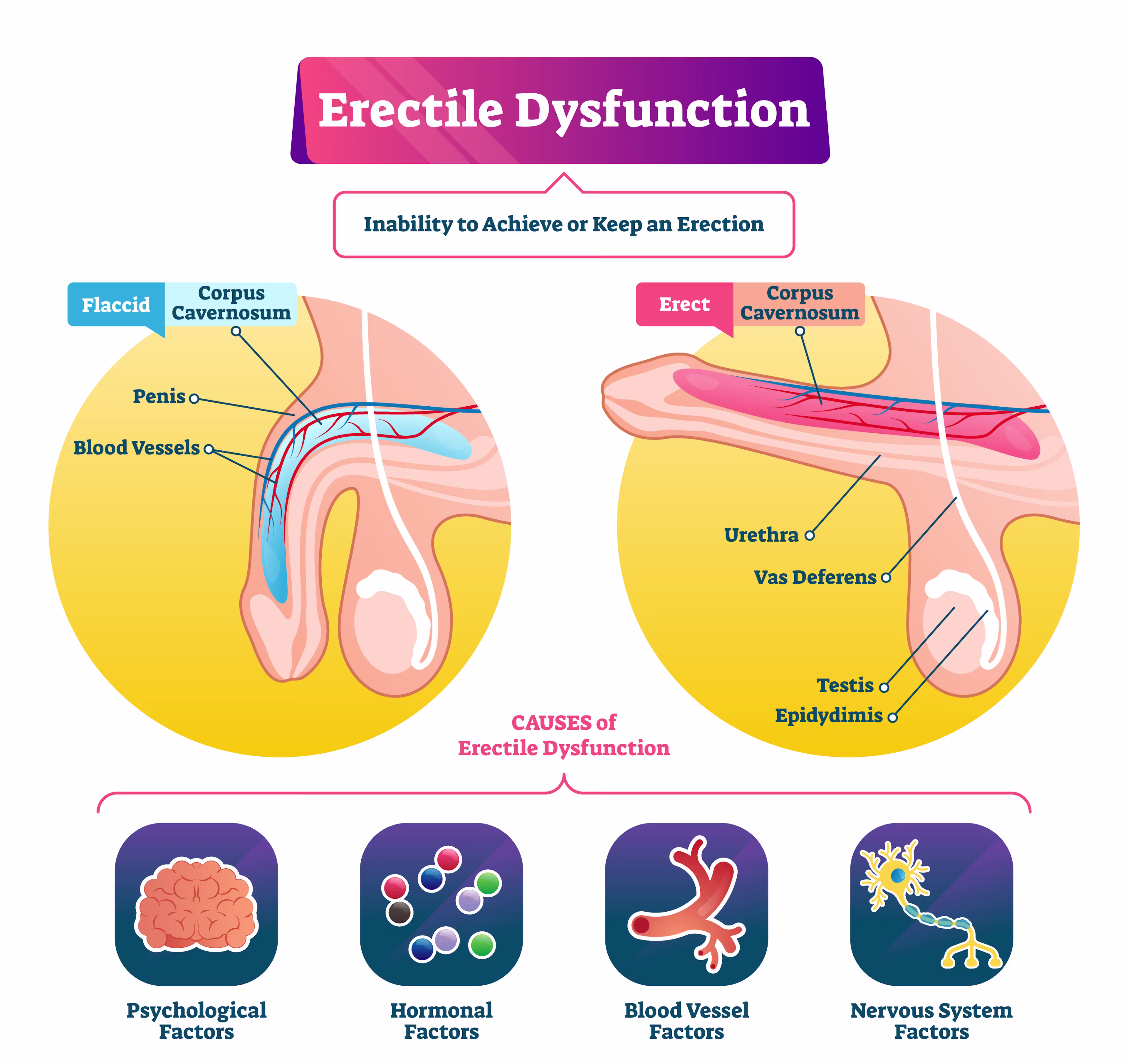 craving sugar on tirzepatide Does Tirzepatide Cause Erectile Dysfunction? How a Quiet Worry Follows a  New “Miracle” Drug