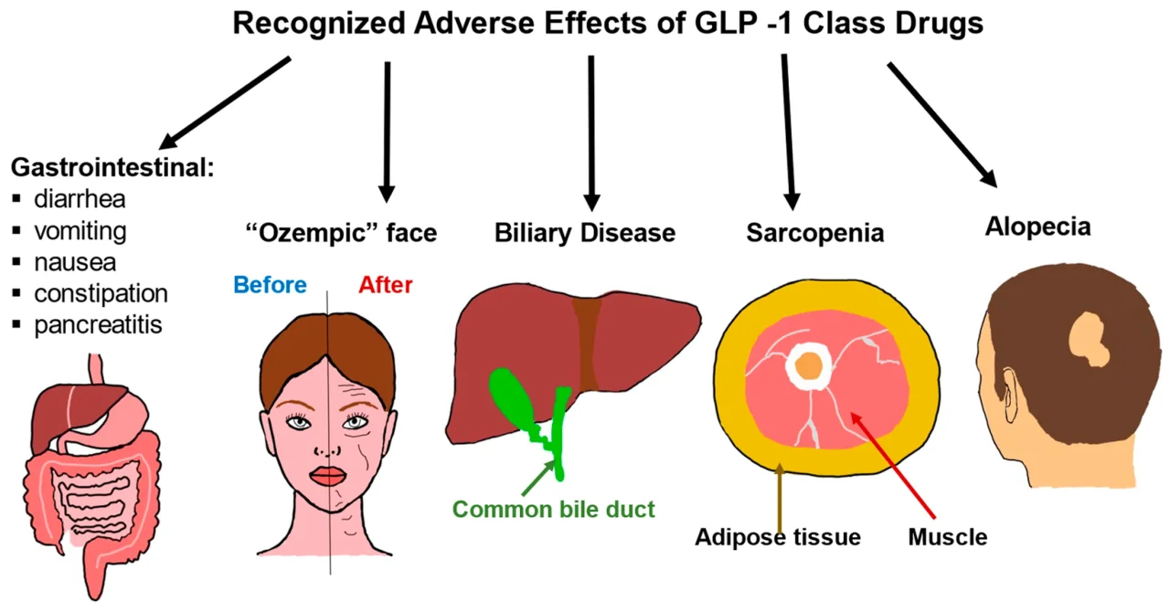 do you have to take glp-1 forever Do You Have To Keep Taking GLP‑1 Forever? Real‑Life Outcomes & Choices In  2026