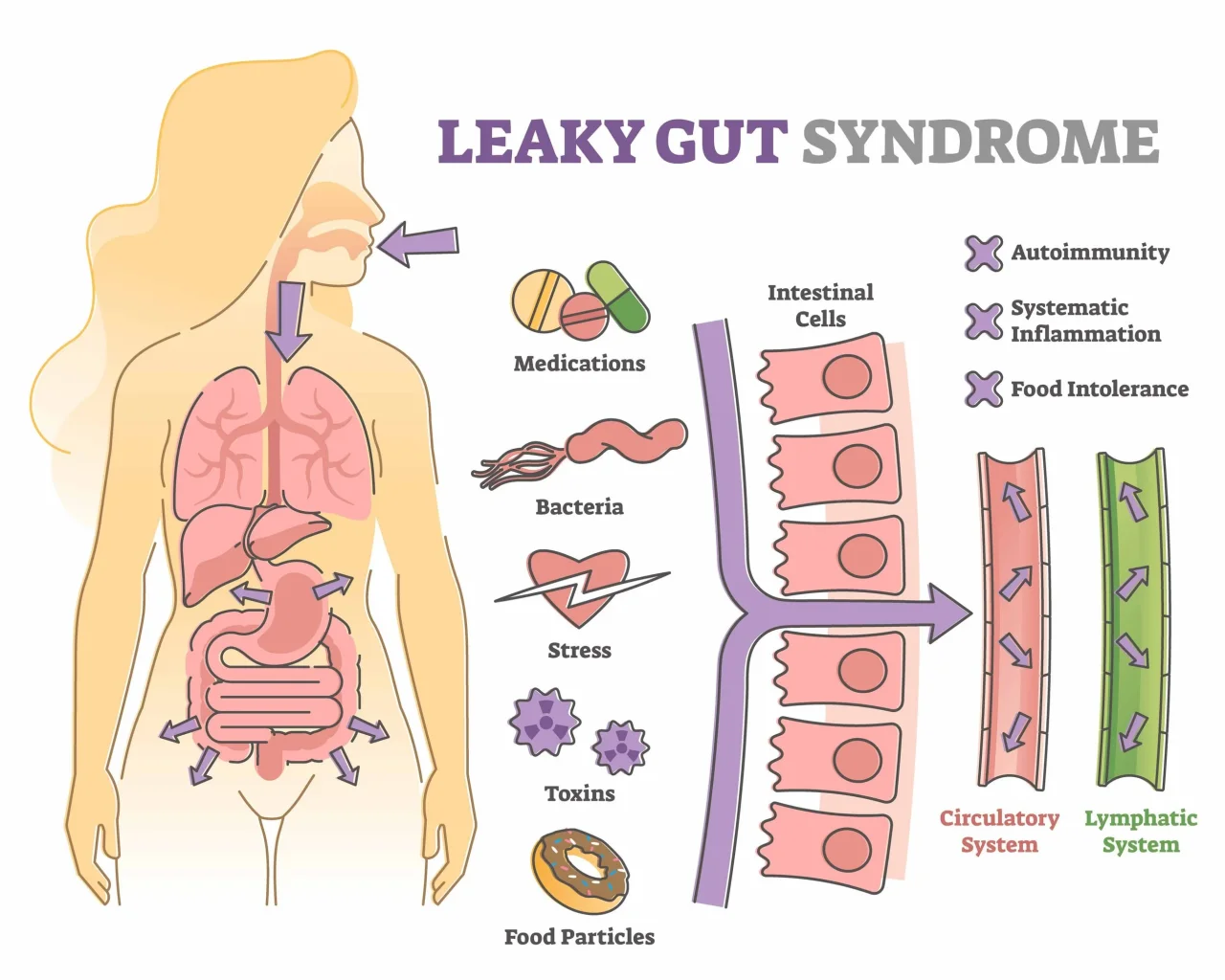 leaky gut glutathione How L-Glutamine's Gut-Healing Power Can Help With Pictures (Symptoms), Skin Breakouts, And More Unlocking Gut Health: The Crucial