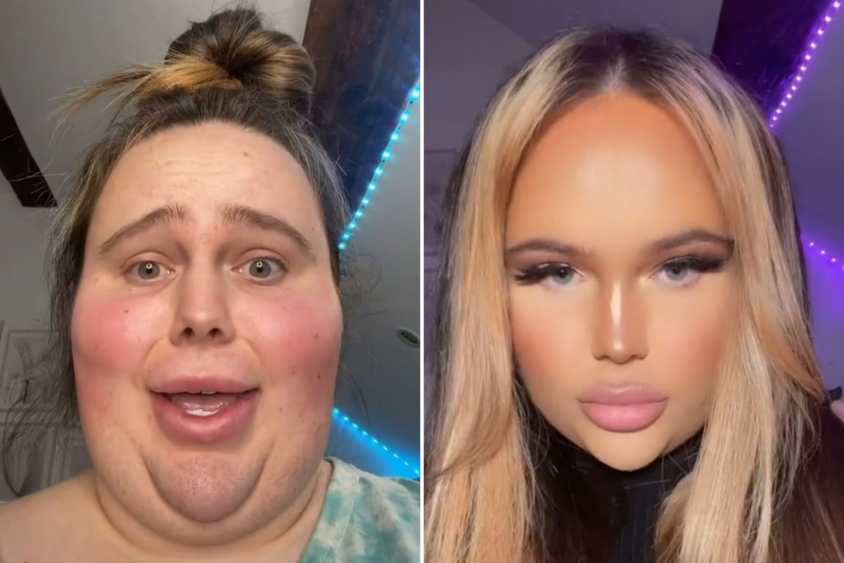 Metformin Weight Loss Results After 2 Months: 7 Studies & 300+ Users Reveal Average Pounds Lost (Not the TikTok Fairytale) Metformin Weight Loss Results After 2 Months: 7 Studies & 300+ Users Reveal Average Pounds Lost (Not the TikTok Fairytale)
