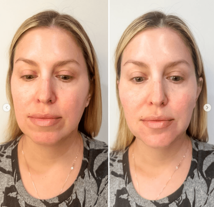 cjc 1295 ipamorelin face flushing reddit Affordable CJC-1295 Peptide Therapy in Florida, Telehealth, Prescription,  Benefits, Side Effects