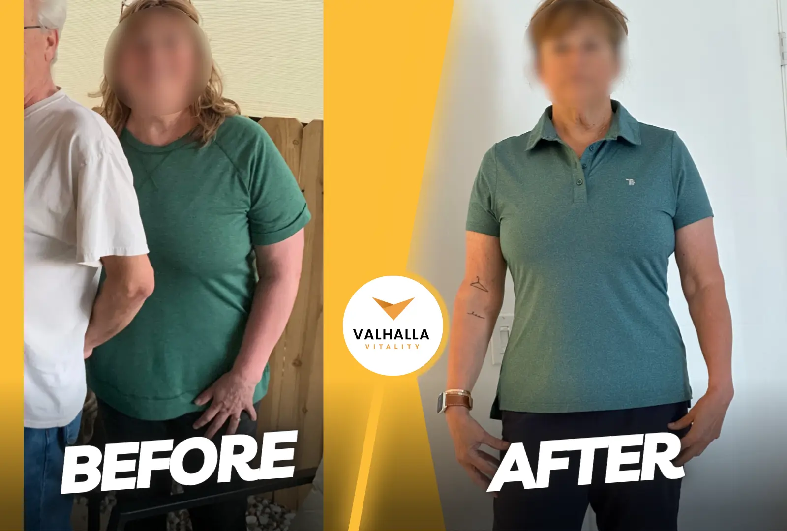 Retatrutide Peptide Results Weight Loss in 2026: What 48 Weeks and 24% Really Feel Like on Your Body