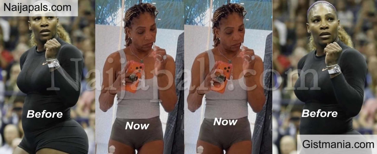 tirzepatide serena williams I would never take a shortcut to living a healthy life. It's really about using the tools available to you to support your health. Thats why its so important to be transparent with my story, Serena Williams Sheds 31 Pounds