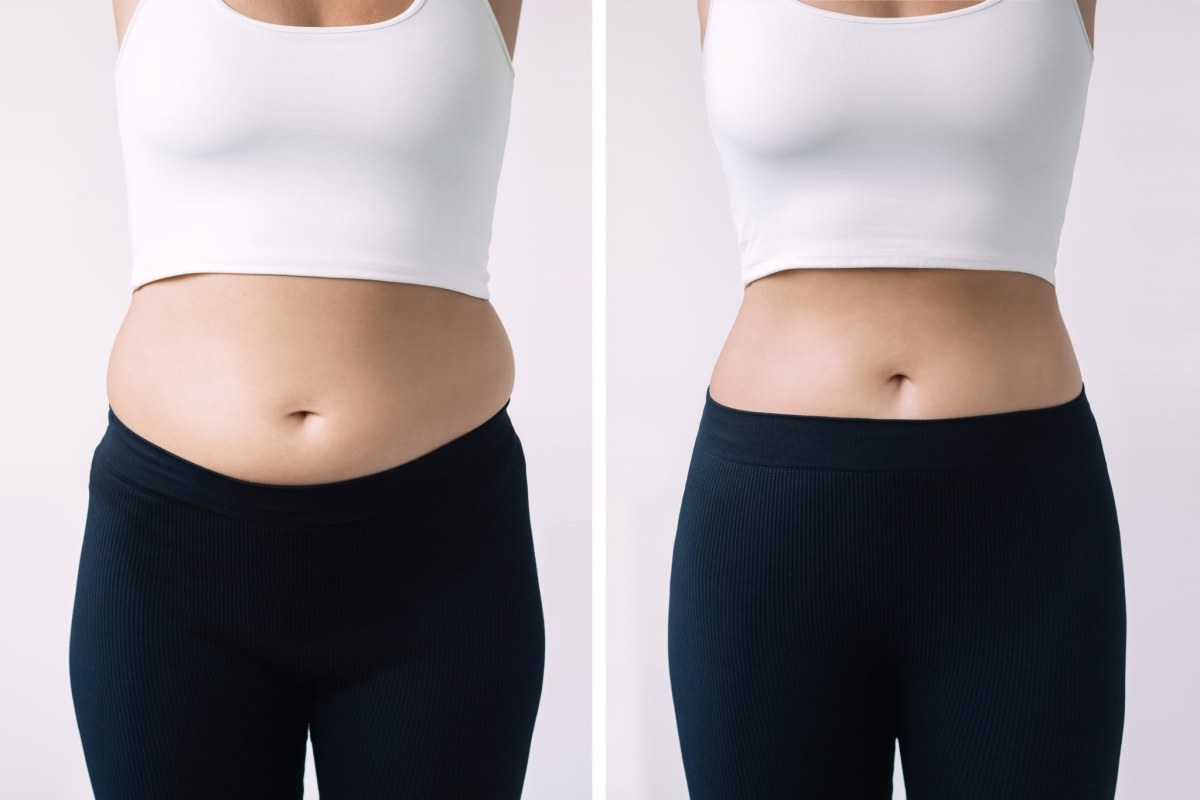 Does Tirzepatide Burn Belly Fat? A Look at Real Waist Measurements and Fat Loss Patterns Does Tirzepatide Burn Belly Fat? A Look at Real Waist Measurements and Fat Loss Patterns